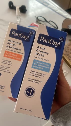 Customer photo review of Acne Creamy Wash 4% Benzoyl Peroxide