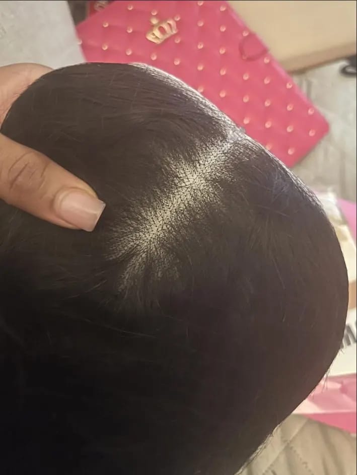 Customer photo review of More Face 13x6 HD Straight Lace Frontal Wigs Pre Bleached Knots Human Hair Wigs With Elastic Drawstring