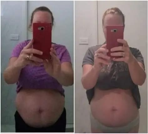 Customer photo review of NextGen Ultra Muscle Stimulator