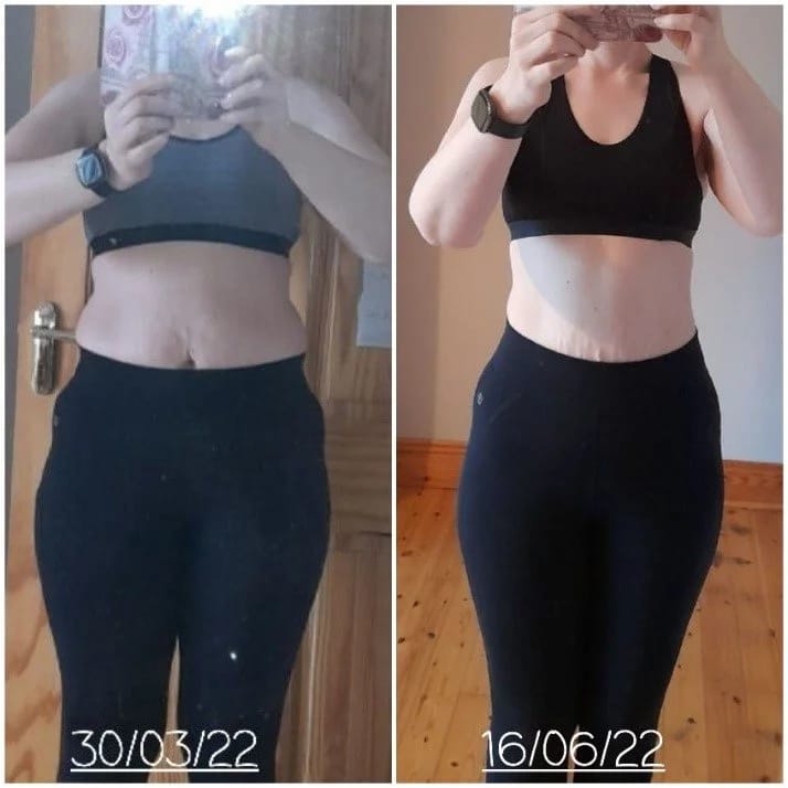 Customer photo review of NextGen Ultra Muscle Stimulator