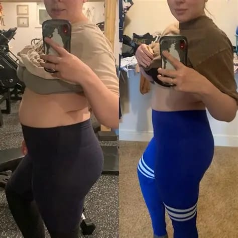 Customer photo review of NextGen Ultra Muscle Stimulator