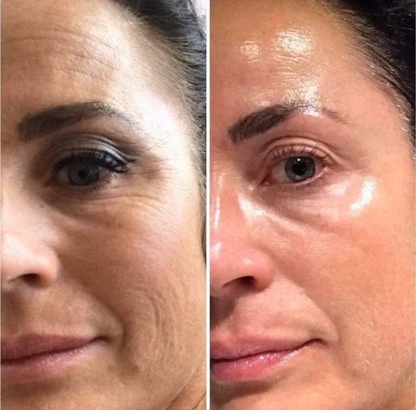 Customer photo review of Crema Anti-ojeras Dr Retinol. Elimina tus ojeras en 7 días