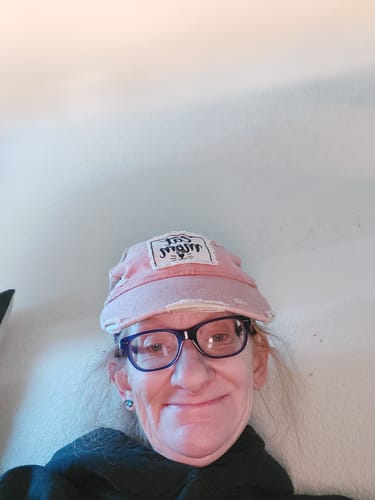 Customer photo review of Grass Fed Tallow & Honey Balm