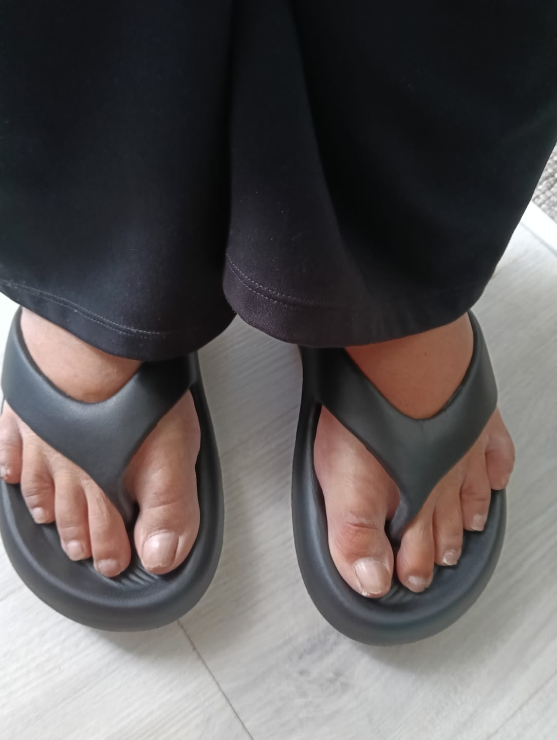 Customer photo review of The Snuggi Arch Support Thongs
