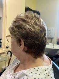 Customer photo review of High-Quality Short Hair Topper For Women With Thinning Hair