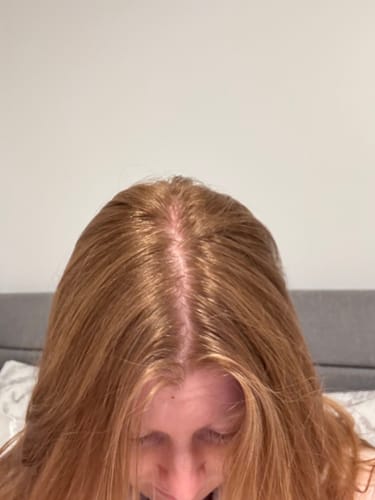 Customer photo review of TR Hair Oil Essentials Bundle ($66 value)