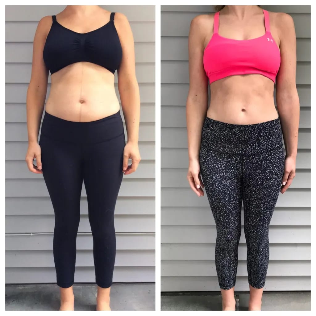 Customer photo review of NextGen Ultra Muscle Stimulator