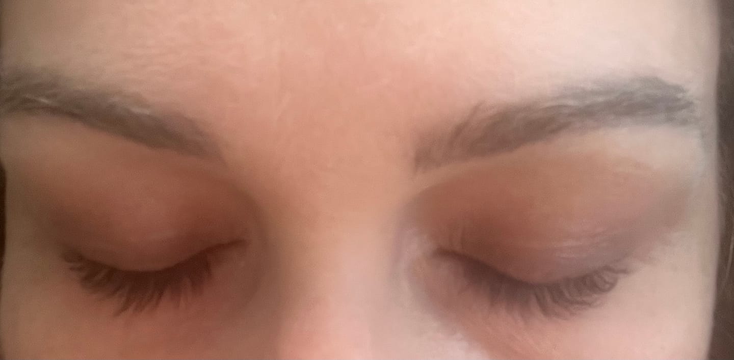 Customer photo review of Purely Lashes Lash Growth Serum