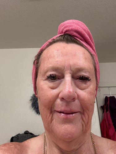 Customer photo review of Grass Fed Tallow & Honey Balm