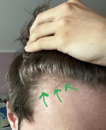 Customer photo review of Volumane Anti-Thinning Stimulating Shampoo
