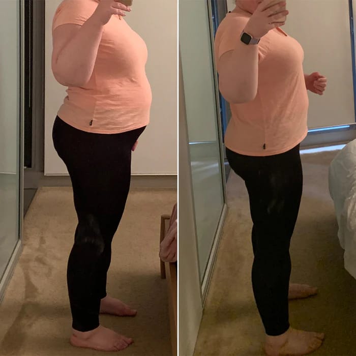 Customer photo review of NextGen Ultra Muscle Stimulator
