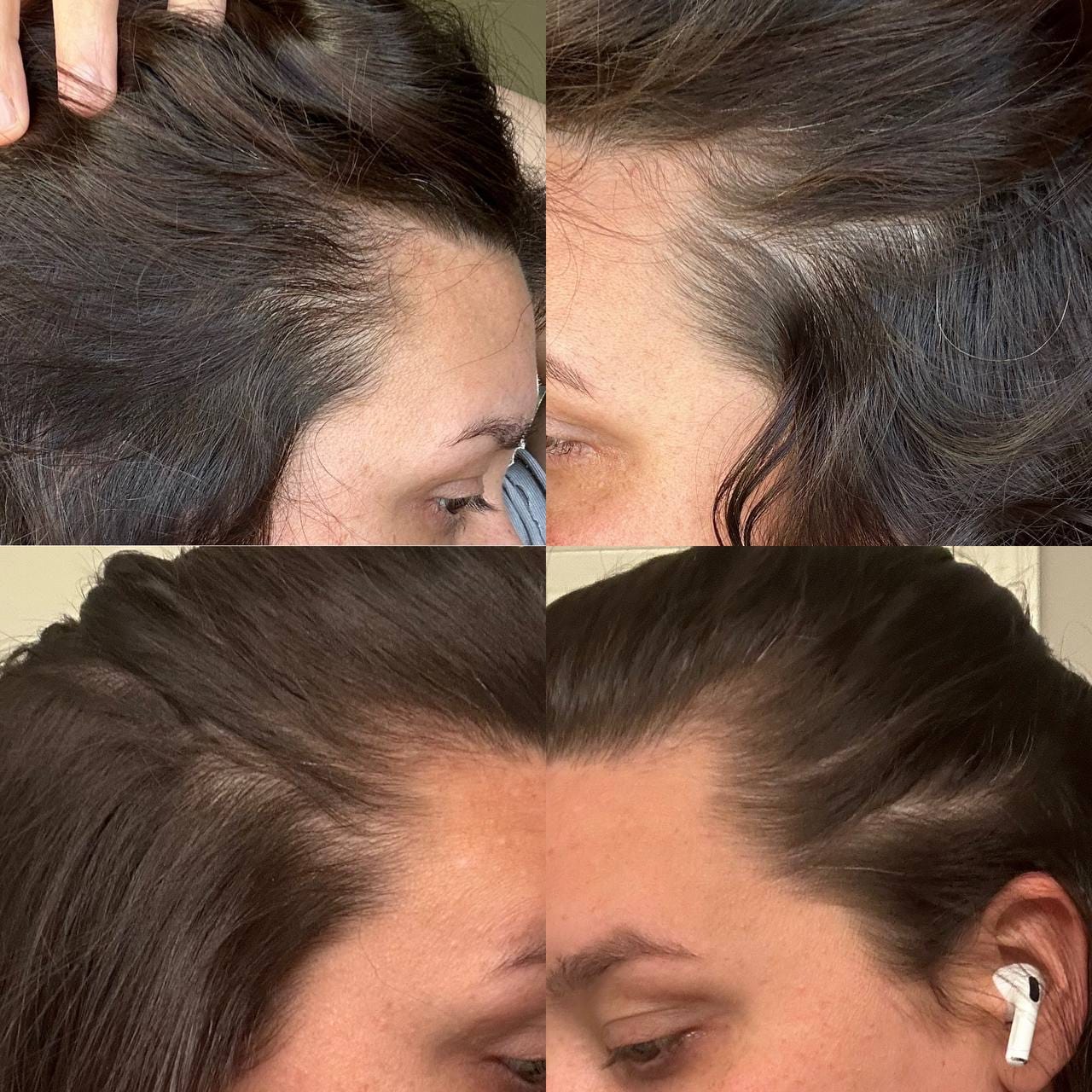 Customer photo review of Hair Growth Serum
