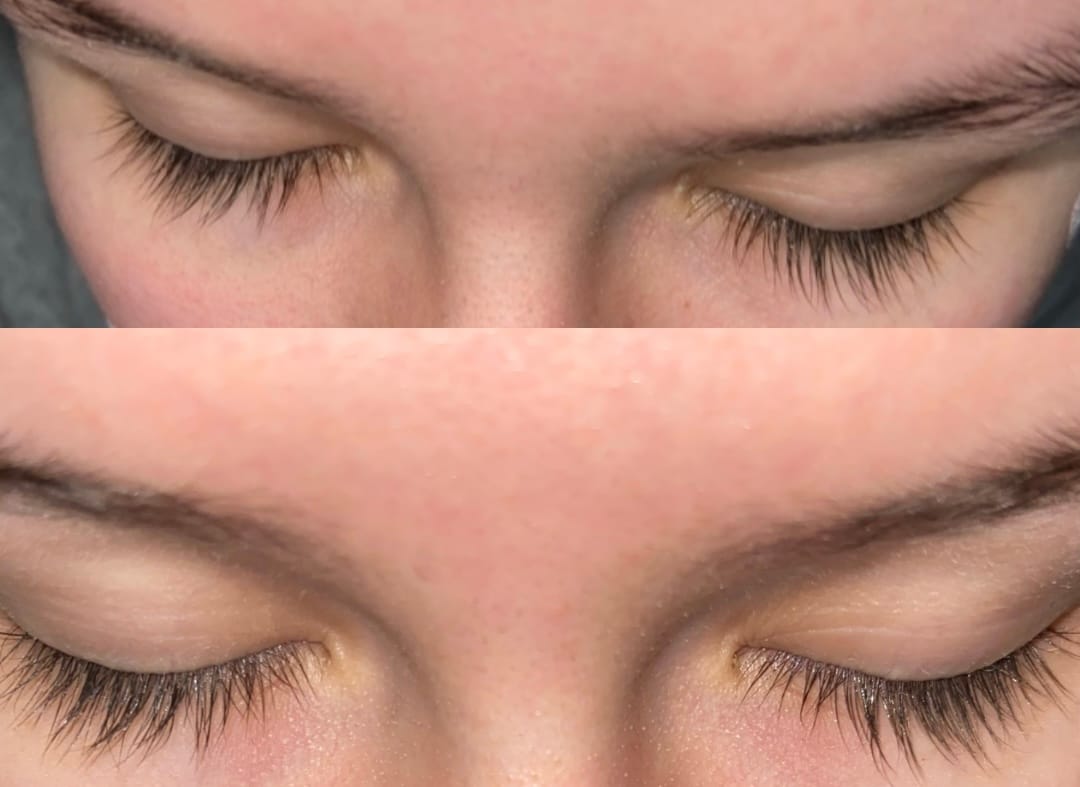 Customer photo review of Suero para crecimiento de pestañas y cejas