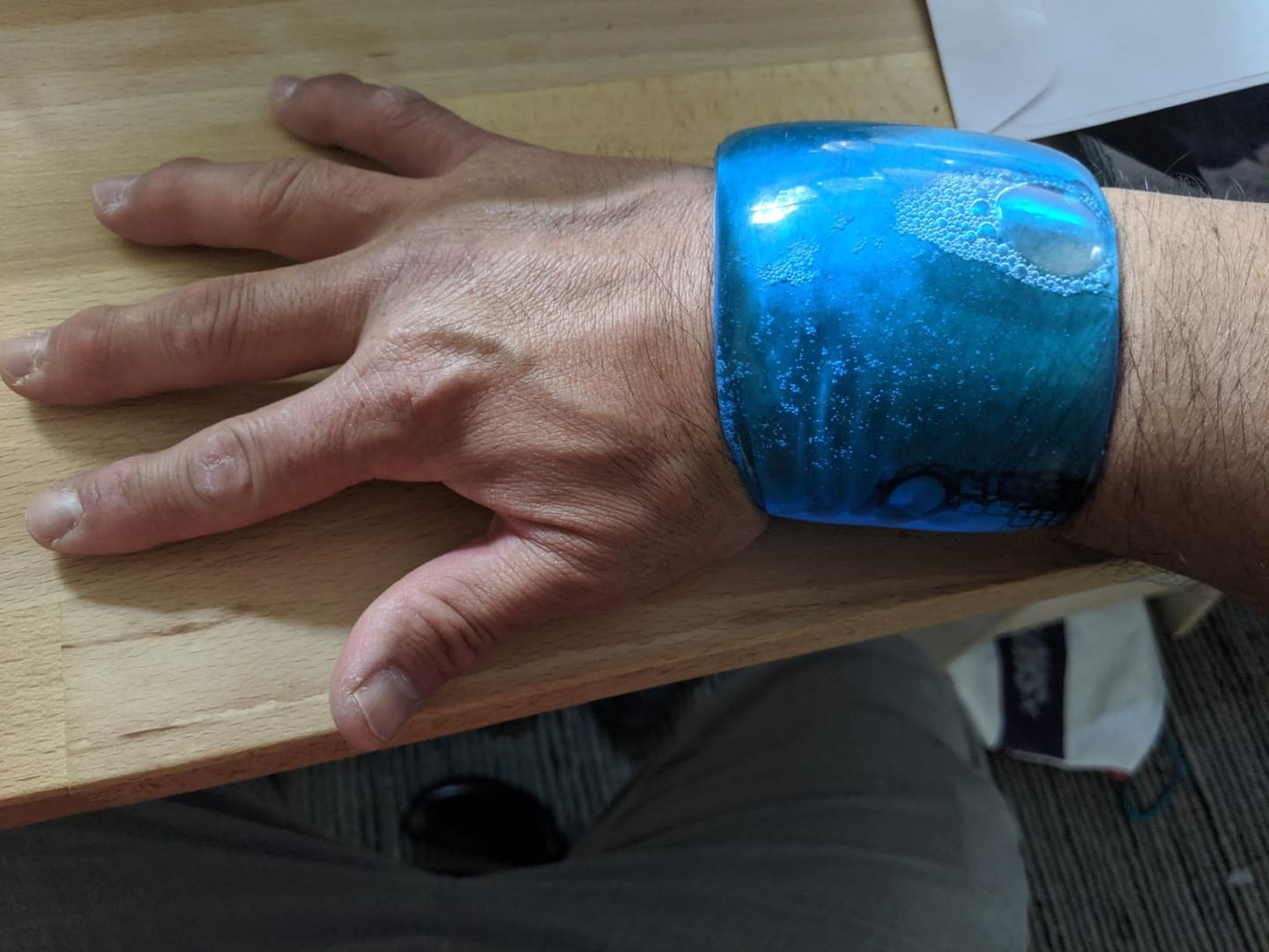 Customer photo review of Penguin Fingers Wrist Cold Compression Pack