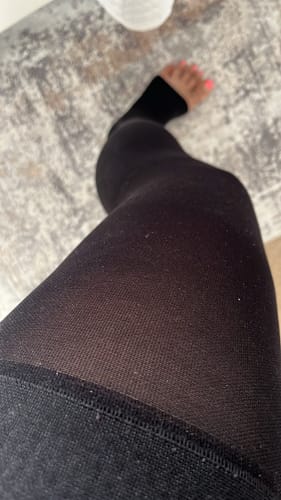 Customer photo review of Sigvaris Opaque Open Toe Thigh High (both for Men & Women)