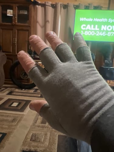 Customer photo review of Premium Onecompress™ Gloves