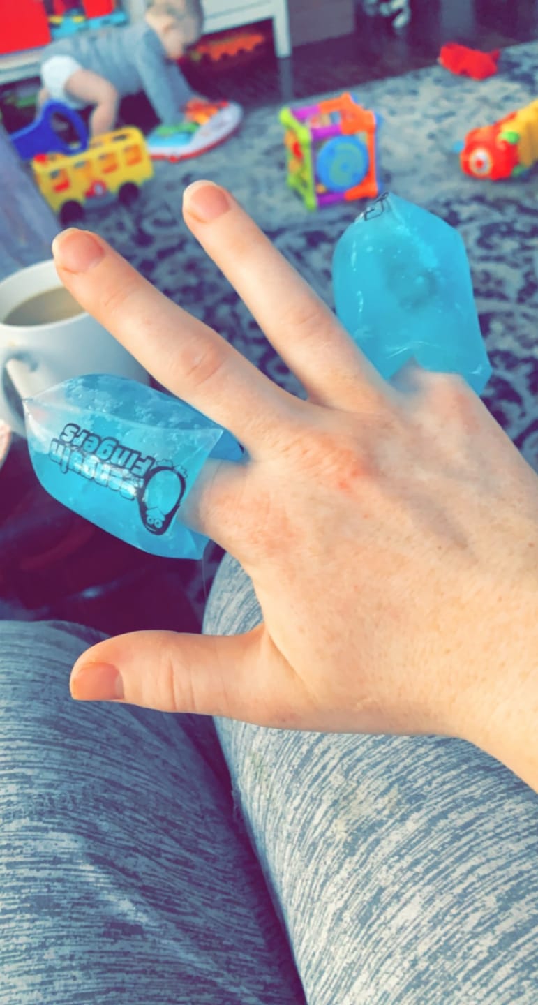 Customer photo review of Penguin Fingers Cold Compression Gel Packs for Fingers and Toes
