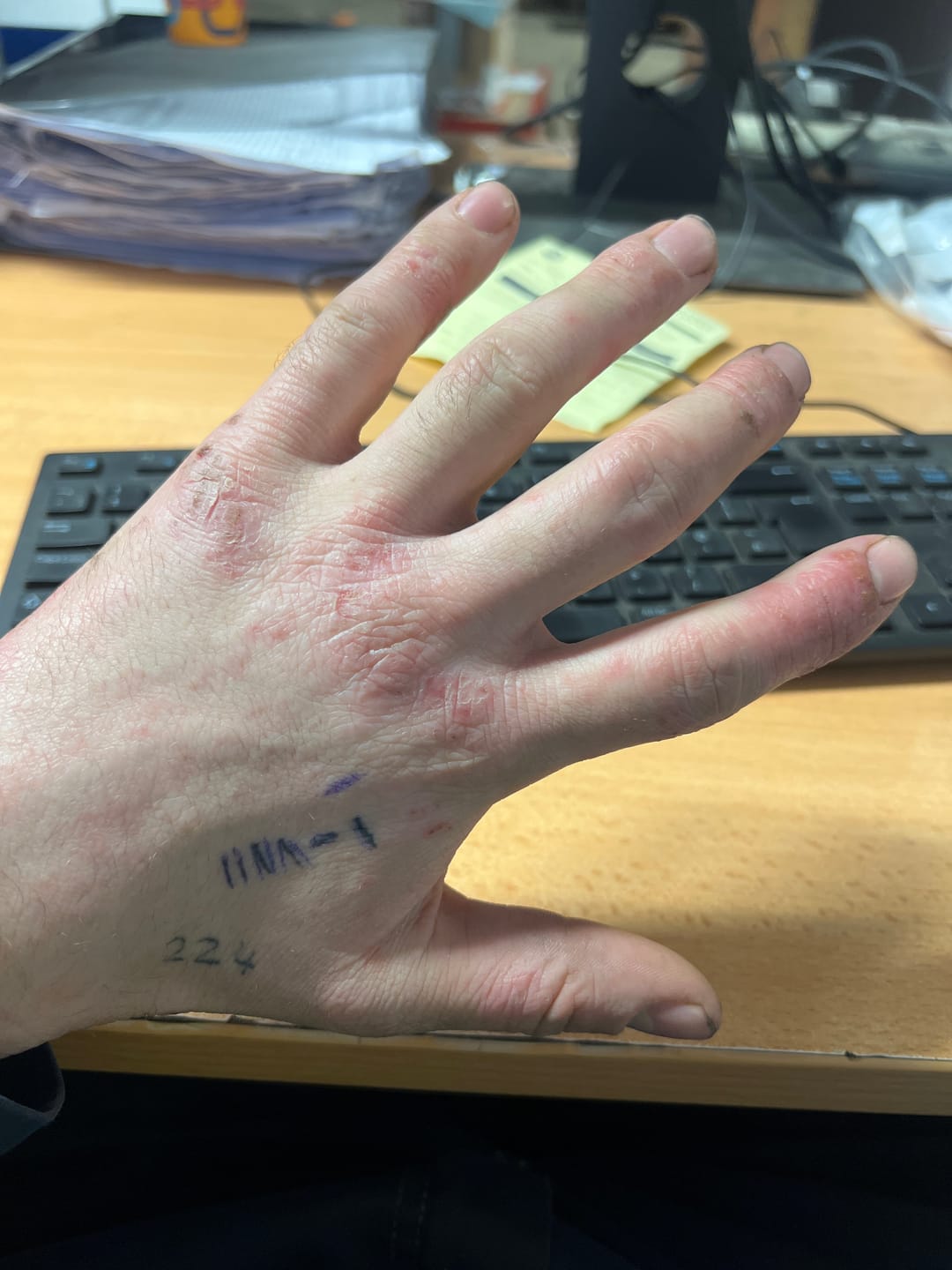 Customer photo review of Bioskin Duo Pack