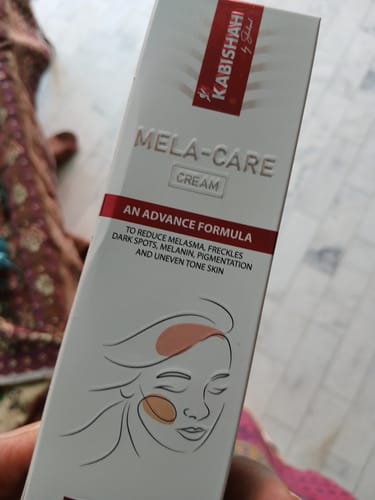 Customer photo review of Pigmentation Bundle: Face Wash & Melasma Cream Duo