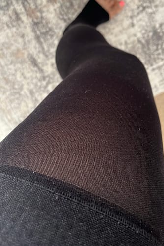 Customer photo review of Sigvaris Opaque Open Toe Thigh High (both for Men & Women)