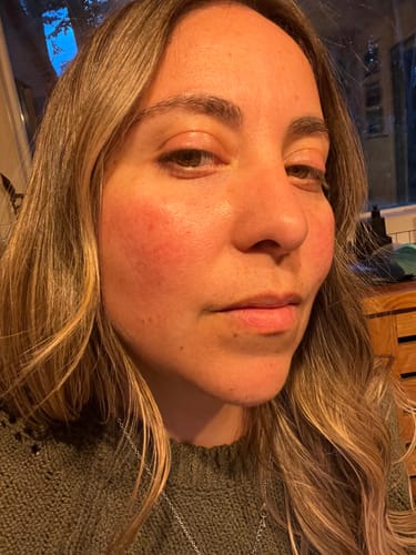 Customer photo review of Varita Infinite Glow & Serum Activador