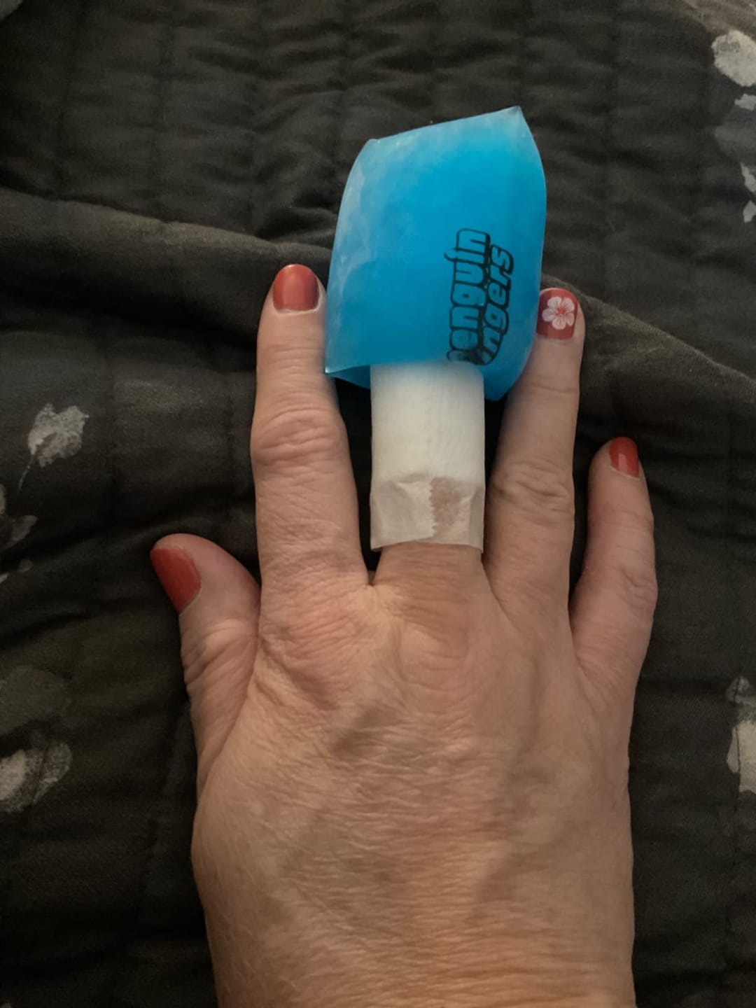Customer photo review of Penguin Fingers Cold Compression Gel Packs for Fingers and Toes