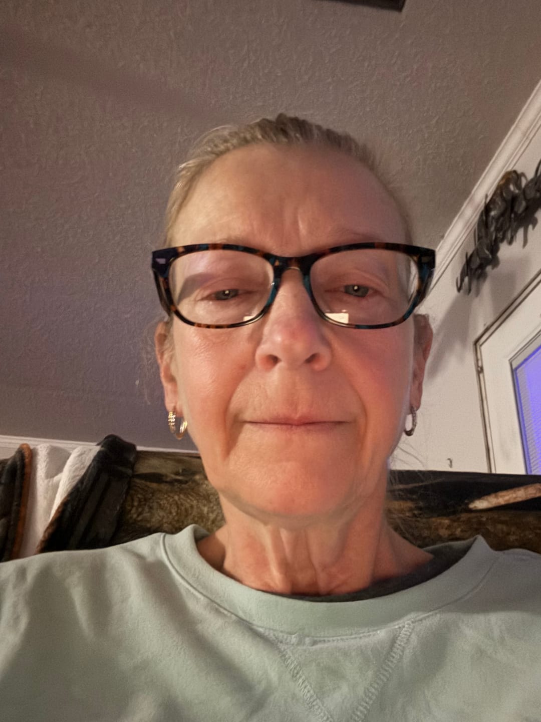 Customer photo review of 3 Month Supply - Micro Infusion Patches