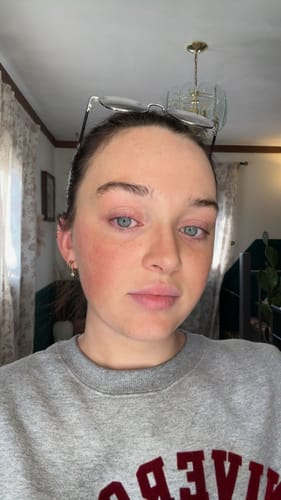 Customer photo review of Acqua Hydrating Face Mist (Self-Tanning Water)