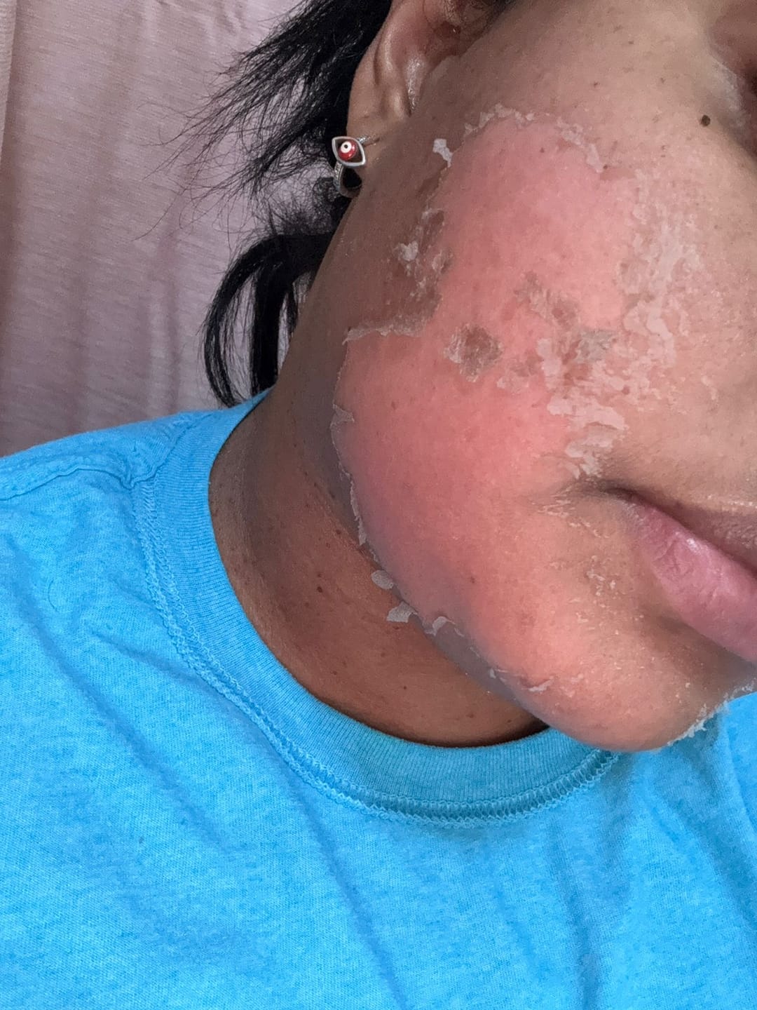 Customer photo review of Zena 100% Organic Algae Peel