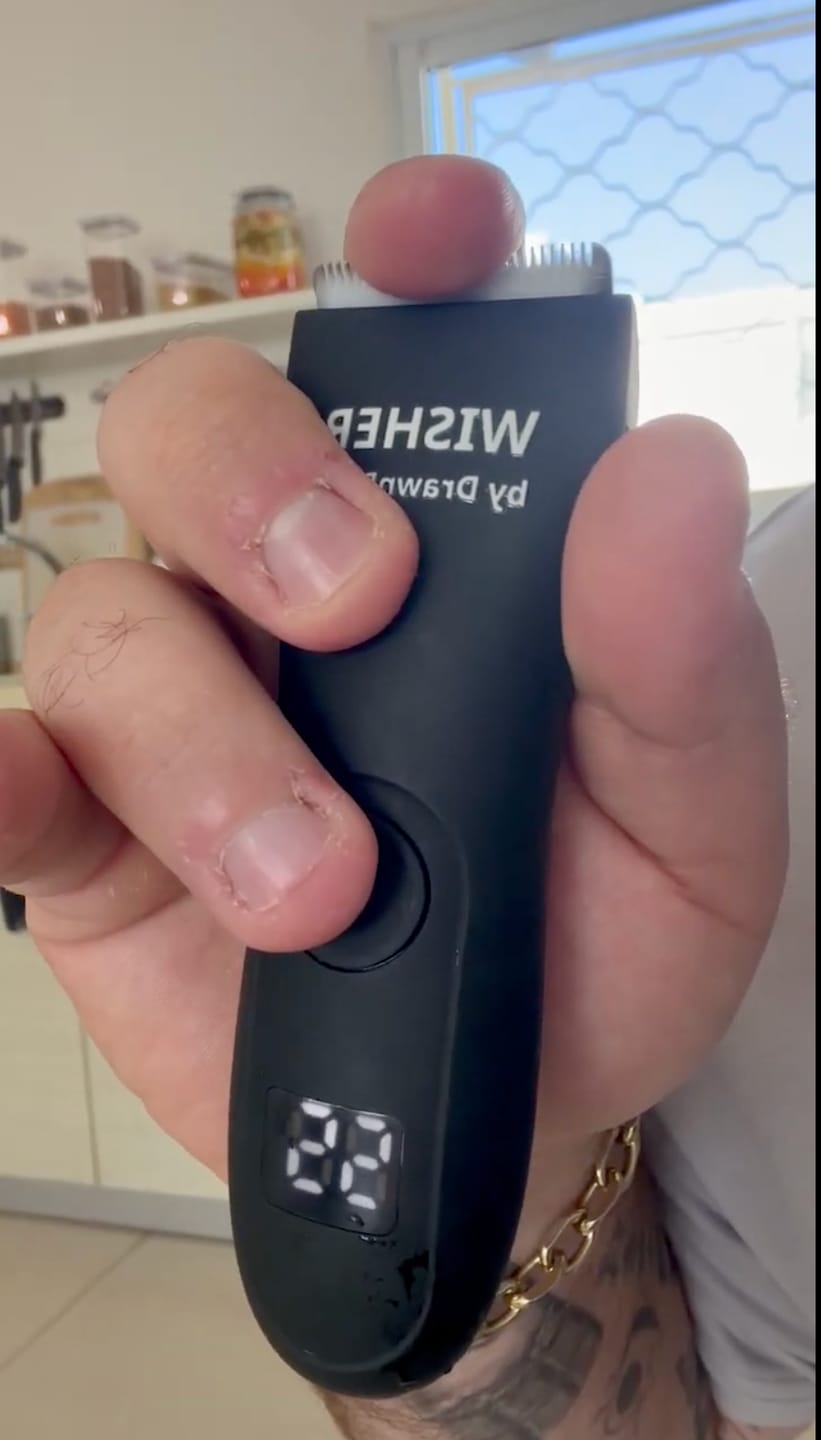Customer photo review of מכונת הגילוח – WISHER לגילוח חלק ובטוח
