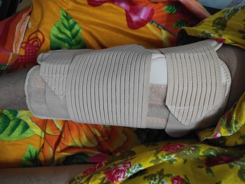 Customer photo review of Knee Brace - Long (19" Brace) | Ideal firm Knee support that limits knee motion & stabilizes the knee with mediolateral metal supports | Color - Beige