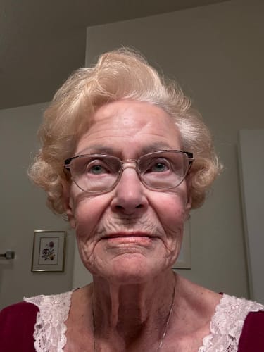 Customer photo review of 3 Month Supply - Seranova Micro Infusion System