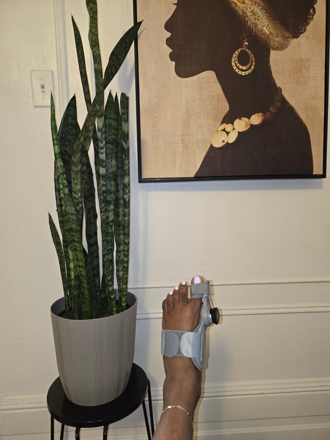 Customer photo review of Treatmedy™ Bunion Fix