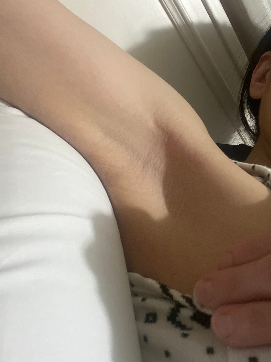 Customer photo review of Ulike Air10家用除毛儀