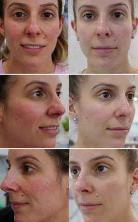 Customer photo review of Glow Back in Time Mega Bundle