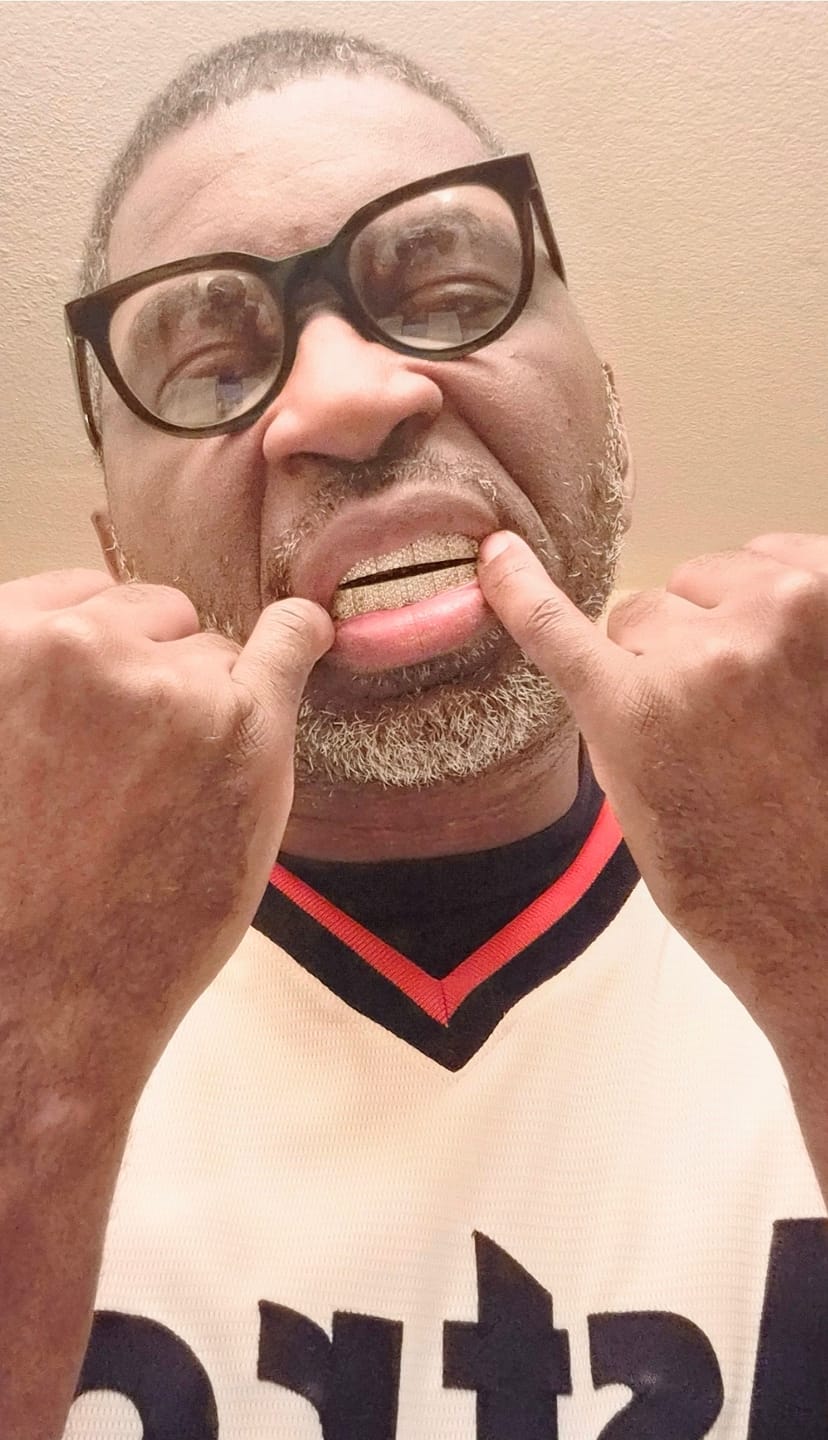 Customer photo review of 8 Tooth Standard Iced Grillz - White Gold
