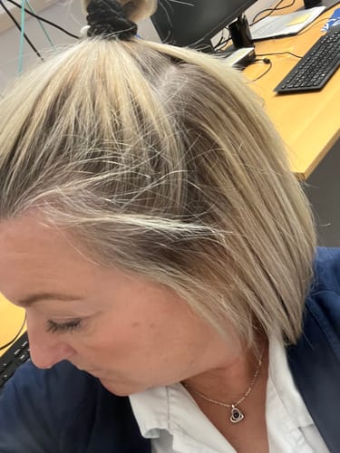 Customer photo review of Sunkissed Starter Kit