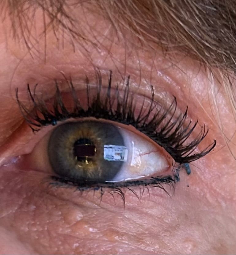Customer photo review of THE CANCER (Krebs 5-11 mm)