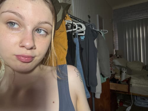 Customer photo review of Goldy AM Serum