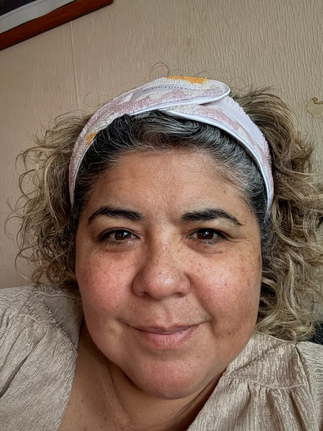 Customer photo review of Serena Skincare Kit