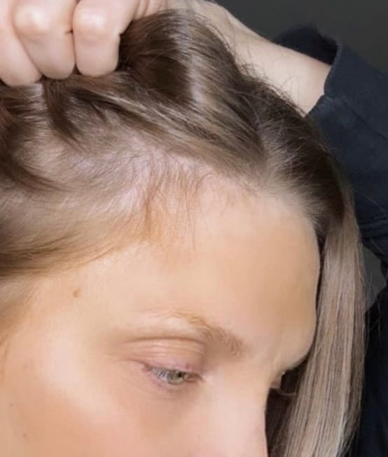 Customer photo review of Hair Growth Serum