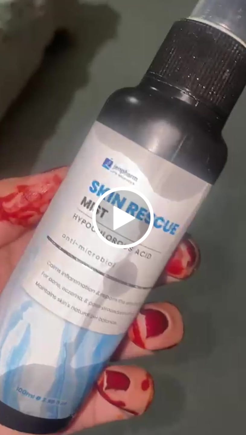 Customer video review of Skin Rescue Mist