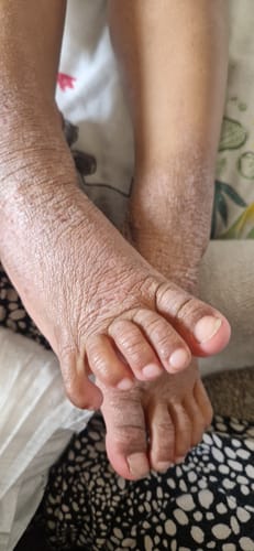 Customer photo review of Calm Balm