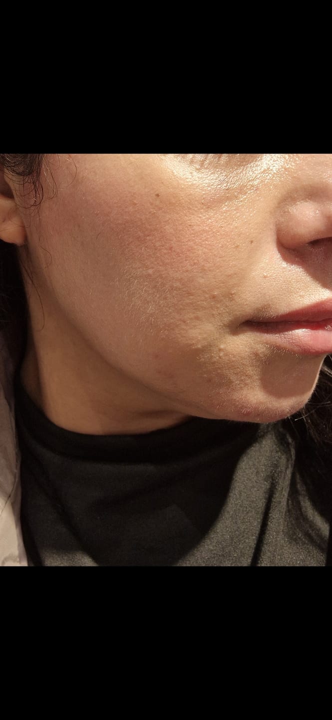 Customer photo review of Black Month: Premium Haarfrei Bundle