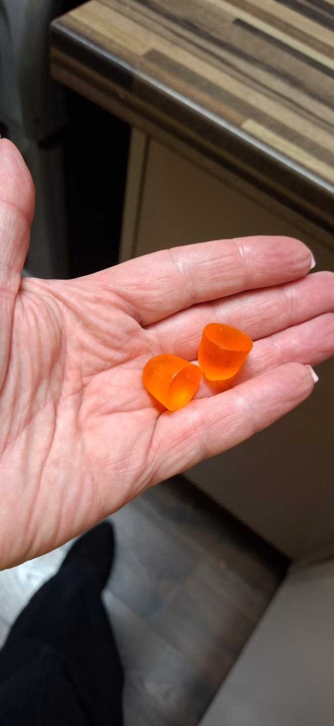 Customer photo review of Pineapple Vaginal Probiotic – 60 Gummies