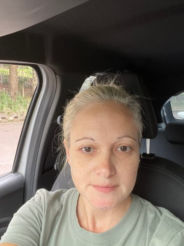 Customer photo review of The Glo Bright Serum