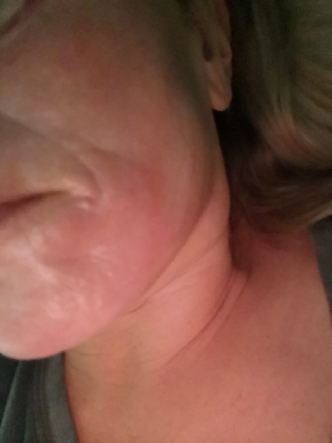 Customer photo review of Pro Face Formula - Day & Night Serum