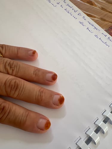 Customer photo review of Collagen 3 Month Supply (750g)