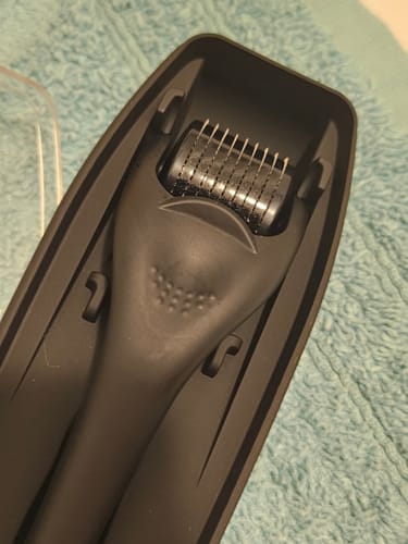 Customer photo review of Scalp Roller