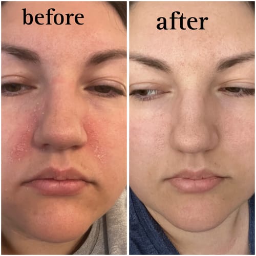 Customer photo review of Seb Natural Calming Serum